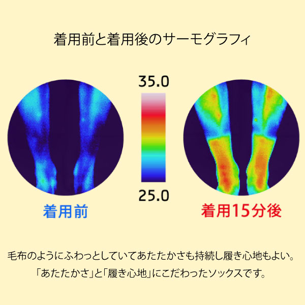 ­餯餯 Ż ۥå   1­  ڥ᡼̵ 2527cm  å  ֳ ΢ »ѡ3